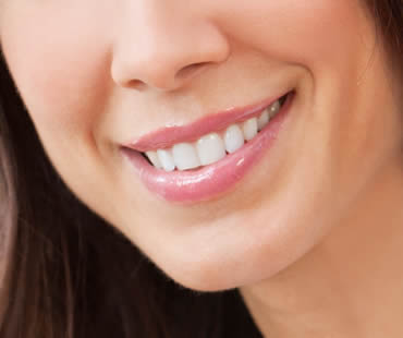 Private: Teeth Whitening and Teeth Bleaching: What’s the Difference?